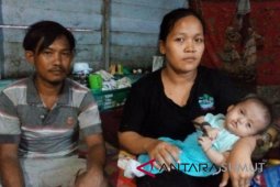 Kasus gizi buruk bertambah di Tanjungbalai