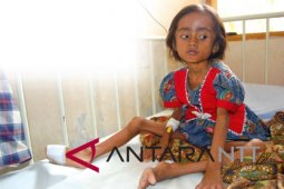 E Nusa Tenggara fights to combat childhood stunting