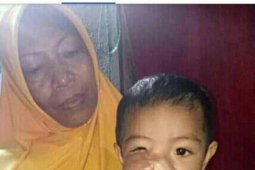 Dinkes Taliabu tangani bayi pengidap tumor
