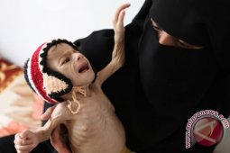 447 warga sipil tewas dalam perang Yaman