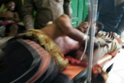 Warga Tebo ditabrak gajah liar menjalani operasi