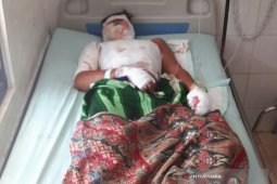 Dua Warga Situbondo Terluka Akibat  Ledakan Petasan