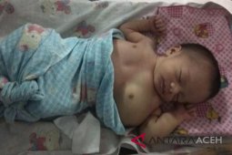 Bayi derita tumor ganas butuh donasi