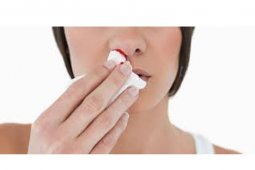 Tips dalam menghadapi anak mimisan