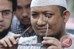 Kondisi mata kanan lebih buruk, KPK minta tambahan biaya pengobatan Novel Baswedan