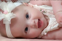 Bayi bermata satu dan tak berhidung lahir di Sumut