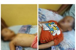 Diduga terjatuh ke kolam, dua anak di Madina ditemukan meninggal