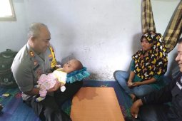 Kapolres Sibolga bantu biaya perobatan anak penderita hydrocephalus