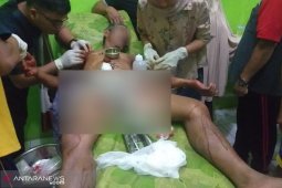 Warga Mukomuko luka parah diserang buaya