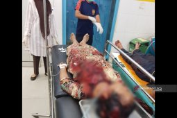 Lelaki dengan gangguan jiwa bacok ibu dan abang kandung di Madina
