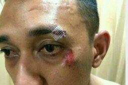 Kapolsek Patumbuk dirawat di rumah sakit, akibat dikeroyok bandar narkoba