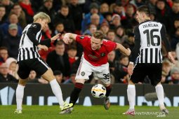 Pemain MU McTominay cedera engkel