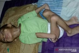 Balita penderita meginitis dan TBC butuh bantuan pengobatan