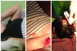Satu keluarga di Stabat Langkat menjadi korban pembacokan