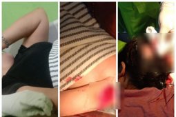Cekcok perkara utang, satu keluarga jadi korban pembacokan