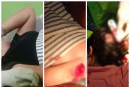 Satu keluarga ini menjadi korban pembacokan