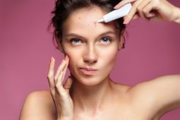 Mengenal dan mengatasi jenis jerawat "fungal"