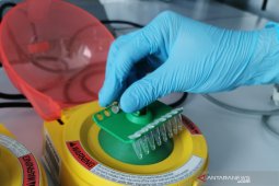 Jubir catat 27 ribu orang telah diperiksa "real time" PCR