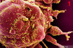 Gambar virus corona diambil dari sampel pasien