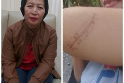 Tiga korban penjambretan di Langkat berharap pelaku dihukum seberatnya