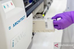 Abbott datangkan alat tes untuk identifikasi antibodi COVID-19