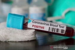 Dokter Ahli tegaskan penyakit COVID-19 bukan aib