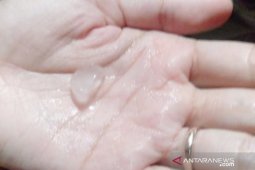 Hujan es di Bogor, berikut penjelasan BMKG