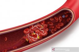 Regulator catat kasus pembekuan darah vaksin AstraZeneca bertambah jadi 168