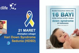 Peringati HDSD, Cordlife  gelar "Down Syndrome Got Talent"