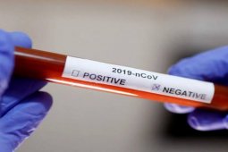 Waduh! Terkonfirmasi positif COVID-19 di Tapsel bertambah lagi