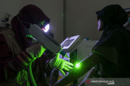 Amankah hilangkan tato gunakan laser?