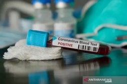 Angka positif COVID-19 di Tapsel naik terus