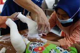 Lombok Care: Ratusan anak di Lombok terlahir kaki pengkor