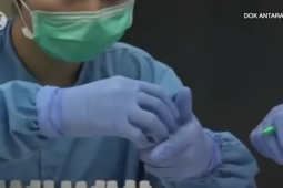 Usia muda harus waspada penyebaran varian delta