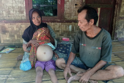 Anak penderita gizi buruk di Lebak butuh bantuan untuk pengobatan
