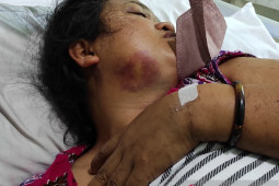 Pratu Abdi gugur saat kontak senjata di Kiwirok Papua