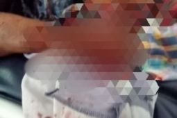 Warga Desa Secanggang Mubin dianiaya pakai kalewang oleh dua orang