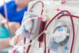 Dokter RSCM sebut banyaknya pasien dialisis anak-anak karena rujukan