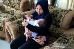 Bayi kembar siam di Deli Serdang butuh uluran tangan