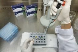 BRIN: Metode RT-LAMP dapat deteksi varian Delta dan Omicron