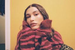 Hailey Bieber pulih usai alami gejala mirip stroke