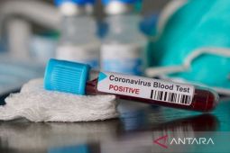 Update COVID-19 Tapsel, positif tercatat enam kasus