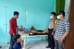 Bocah 11 tahun sebagian tubuhnya melepuh akibat bermain petasan