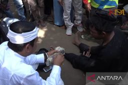 Dedi Mulyadi pulangkan pengemis pura-pura buntung kakinya