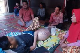 Idap penyakit tumor, anak petani kurang mampu di Palas butuh uluran tangan dermawan