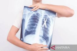 Dokter ingatkan sejumlah risiko penyebab kanker paru