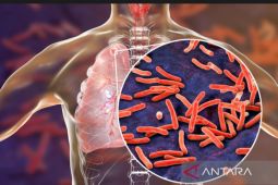 Jumlah penderita penyakit TBC di Lampung Selatan naik pada 2022