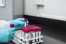 Dokter: Pastikan ginjal sehat dengan pemeriksaan urine dan darah