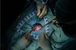 Dokter spesialis "barang langka" di Indonesia