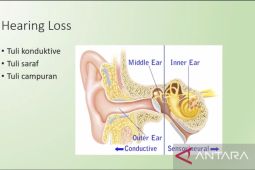 PGPKT soroti harga alat bantu dengar yang mahal